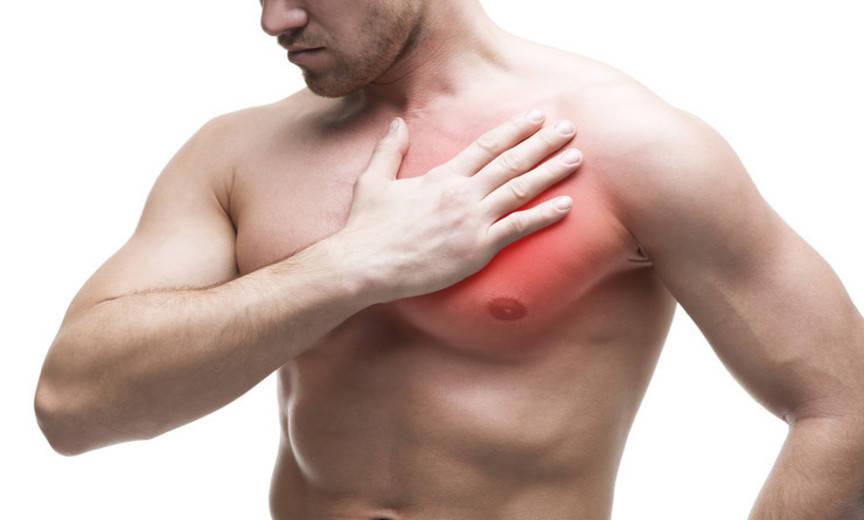 pectoral strain - pulled chest muscle