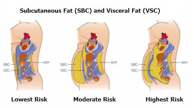 Belly Fat Defined: Subcutaneous Vs Visceral Fat • Bodybuilding Wizard