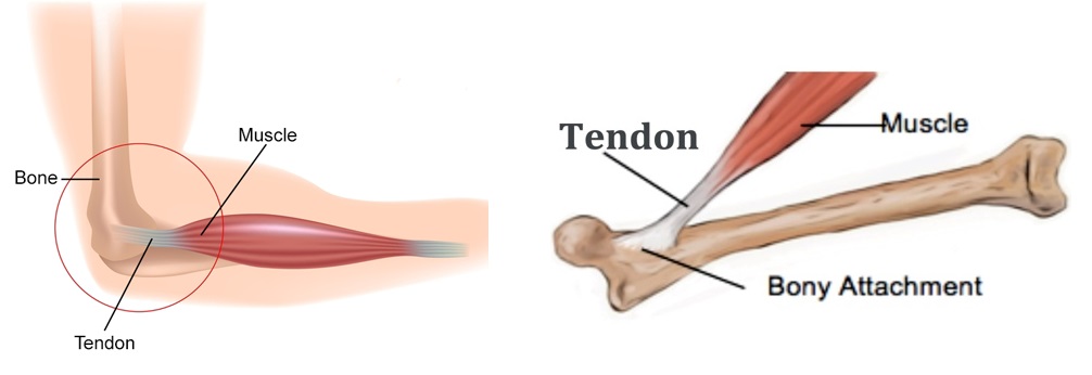 Сухожилие кости. Intramuscular tendon. Muscle attachment.