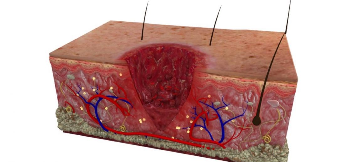 Stages Of Soft Tissue Healing • Bodybuilding Wizard