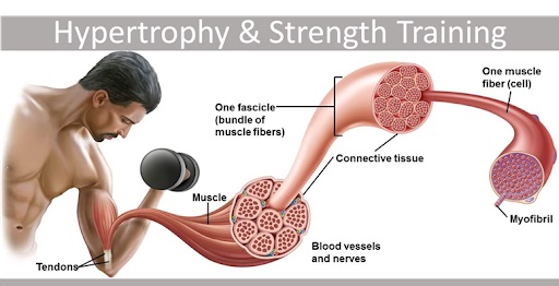 muscle hypertrophy disease